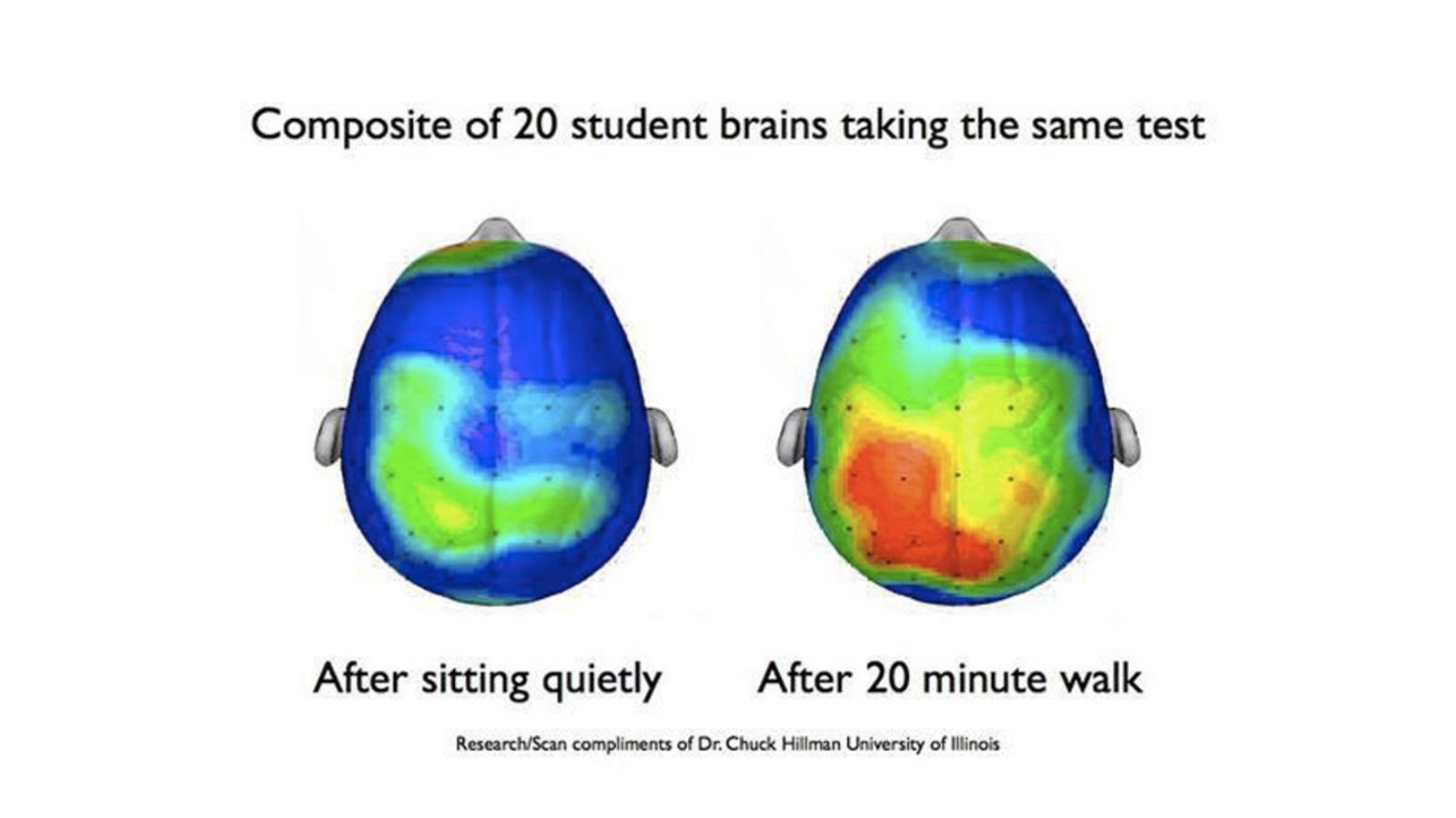 4. brain scan before and after 20 minute walk JandSVision